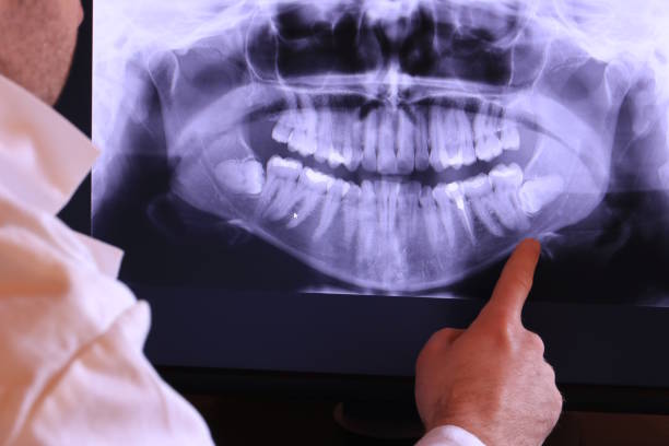 Best Emergency Dentist for Lost Fillings or Crowns in Dalhart, TX