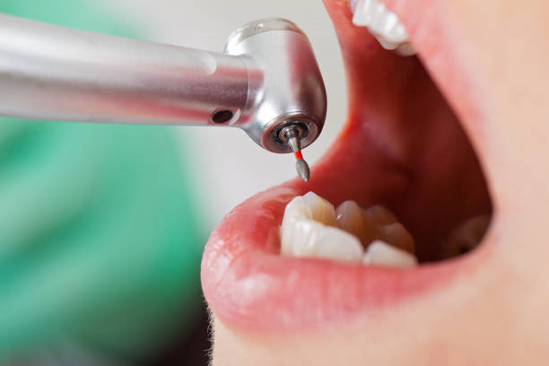 Best Emergency Dental Extractions in Dalhart, TX